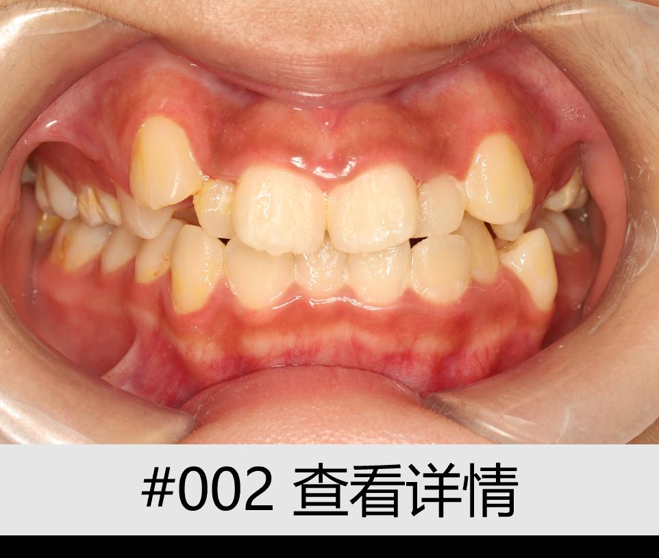 13005