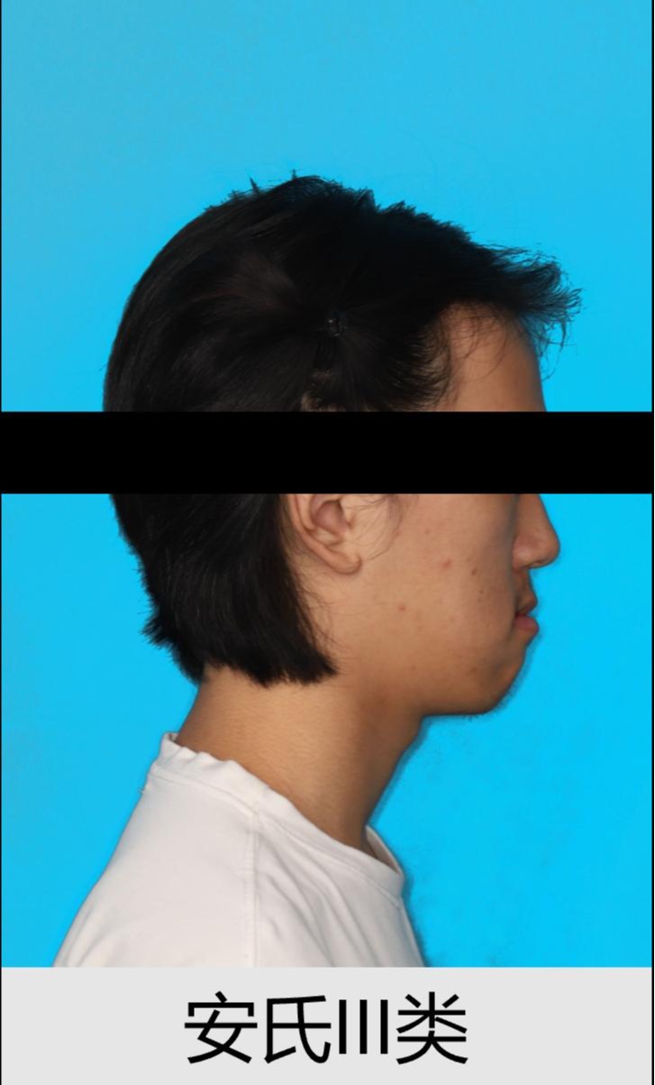 E5CB