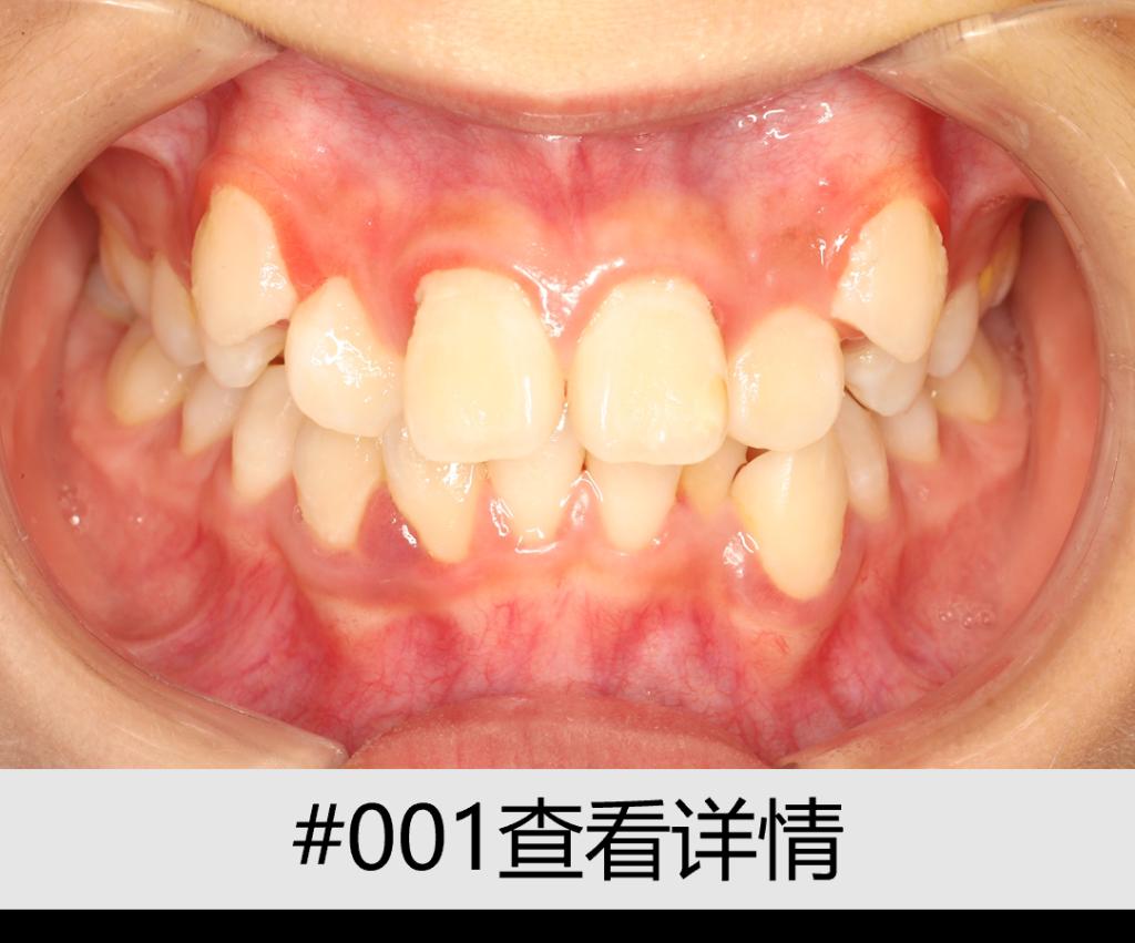 12D82