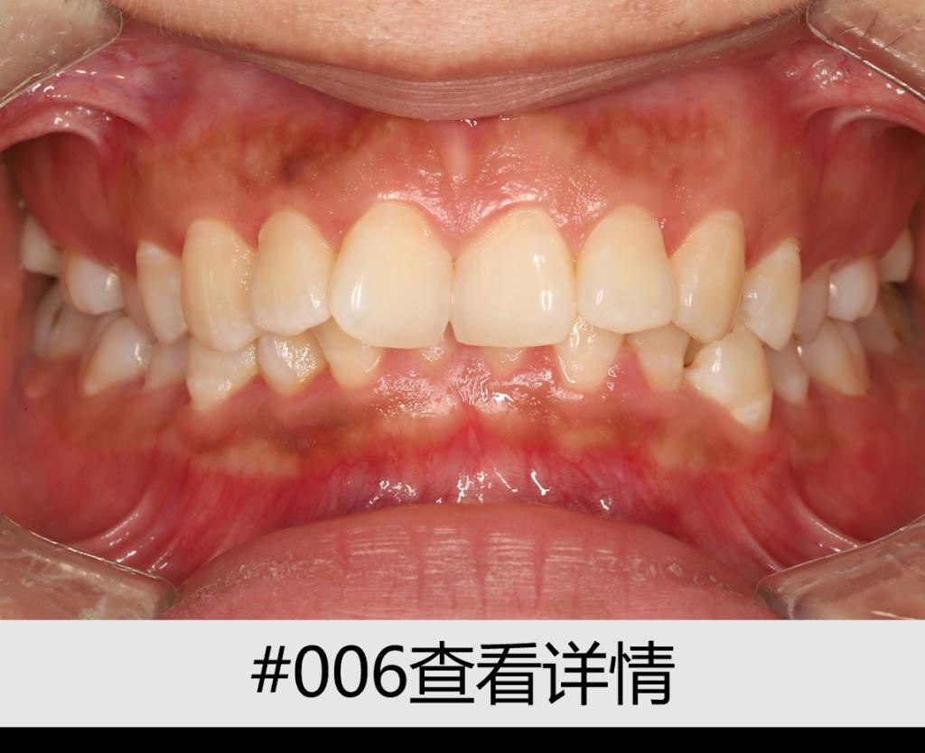 12F80